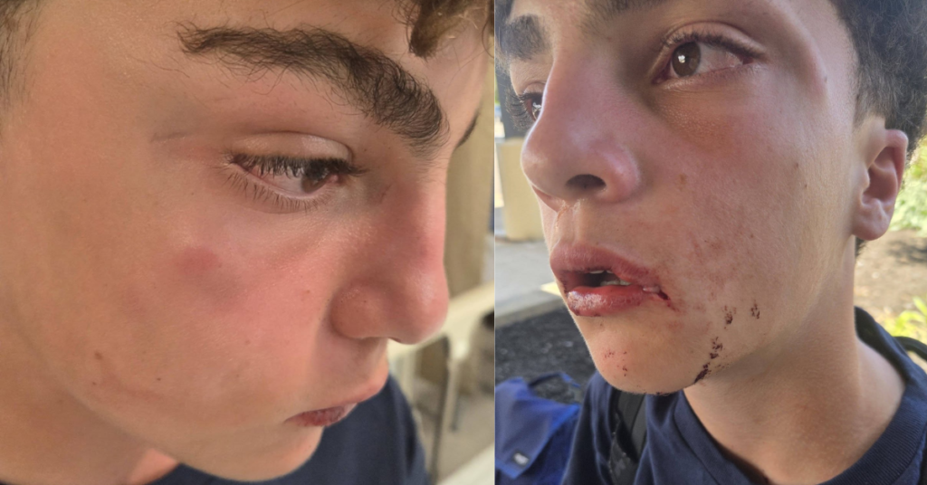 Plainview High School Student and Football Player Attacked With Weapon on Campus, Mom Mindy Milano Demands Accountability From District For Assault Plainview School District Physical Assault