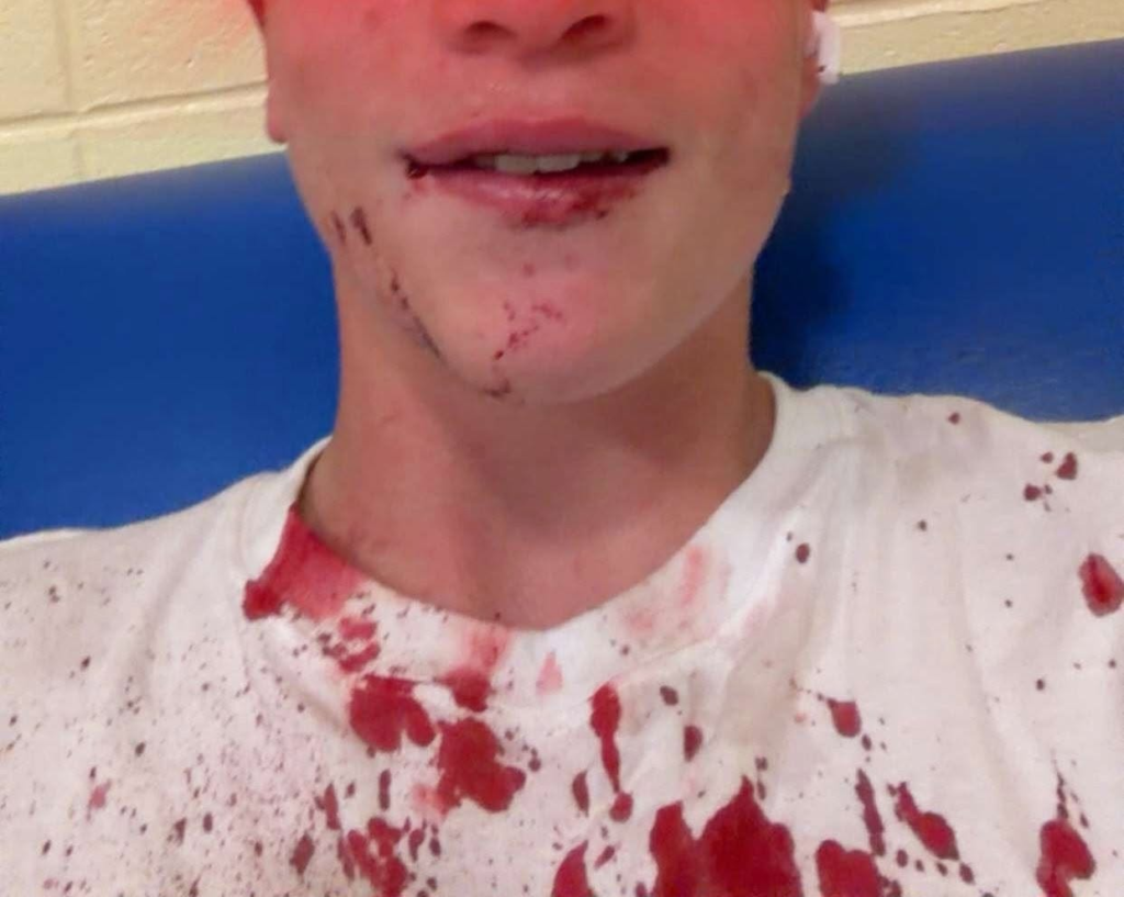 plainview school district assault